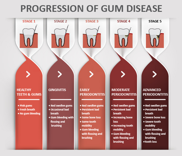 Causes Of Sudden Gum Bleeding