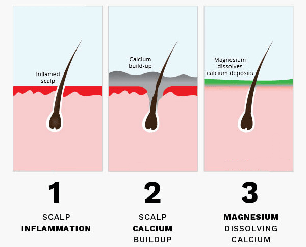 Does Magnesium Promote Hair Growth?